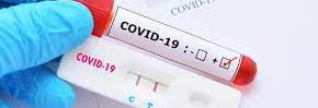 Povinné screeningové testování každé pondělí
