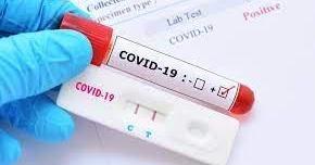 Povinné screeningové testování od 17. 1. 2022